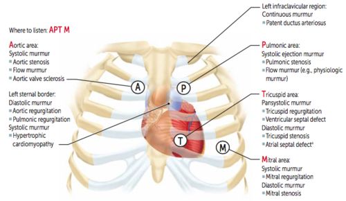 APTM chest reference diagram